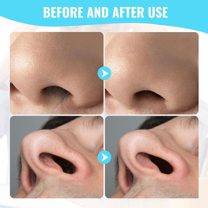 Nose Hair Removal Trimmer Nose Hair Remover Razor Kit Blade (3 Pcs Set) - TezCart