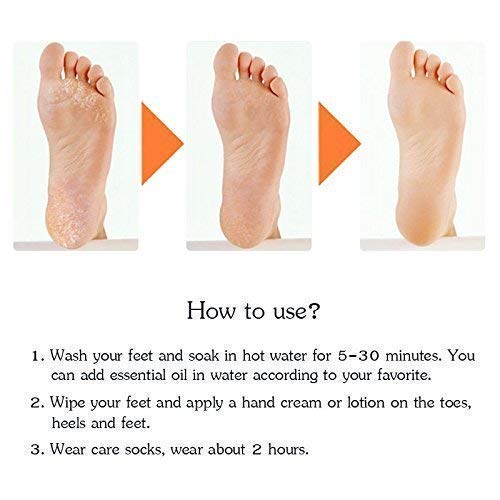 Anti Crack silicone Gel Foot Protector Moisturizing Socks - TezCart